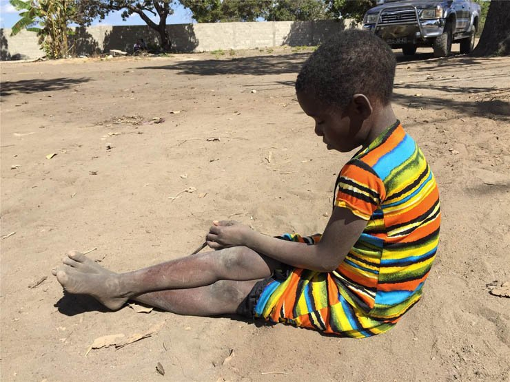 child kid children africa african poor poverty village