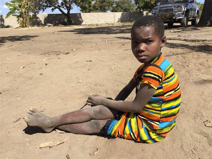 child kid children africa african poor poverty village boy